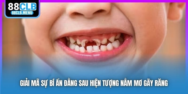 Giải mã sự bí ẩn đằng sau hiện tượng nằm mơ gãy răng